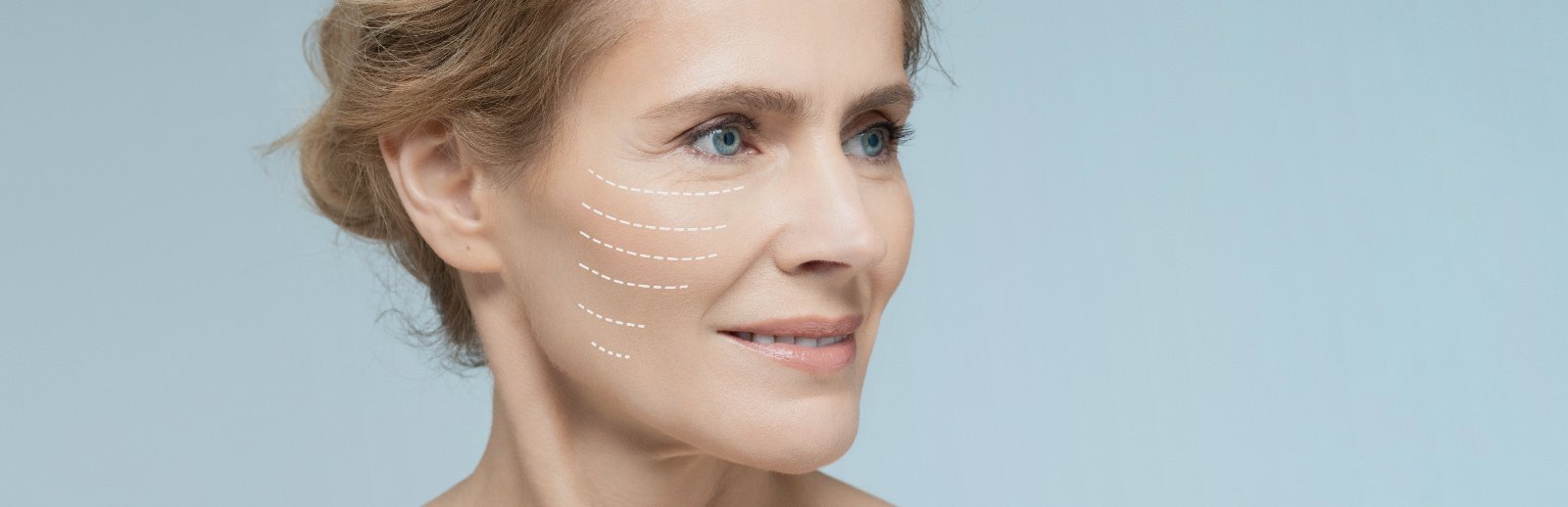 Harmonização facial